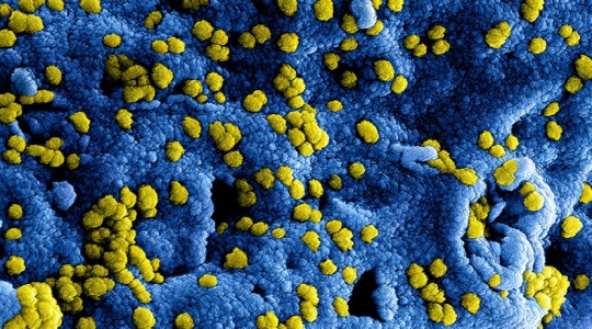 Welzorg maatregelen Coronavirus (COVID-19)