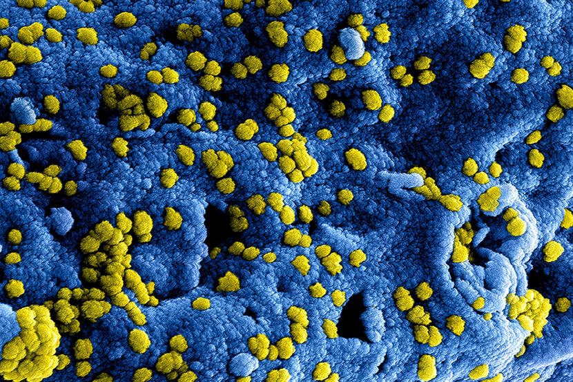 Welzorg maatregelen Coronavirus (COVID-19)